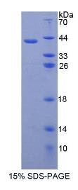 SDS-PAGE (NPHS1-5640H).jpg